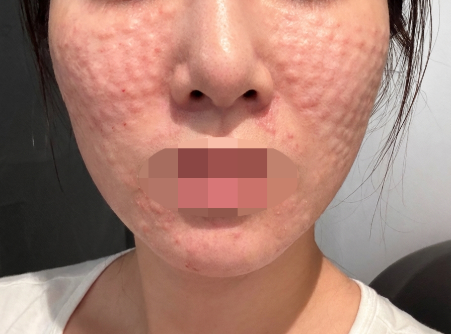 수술후기이미지