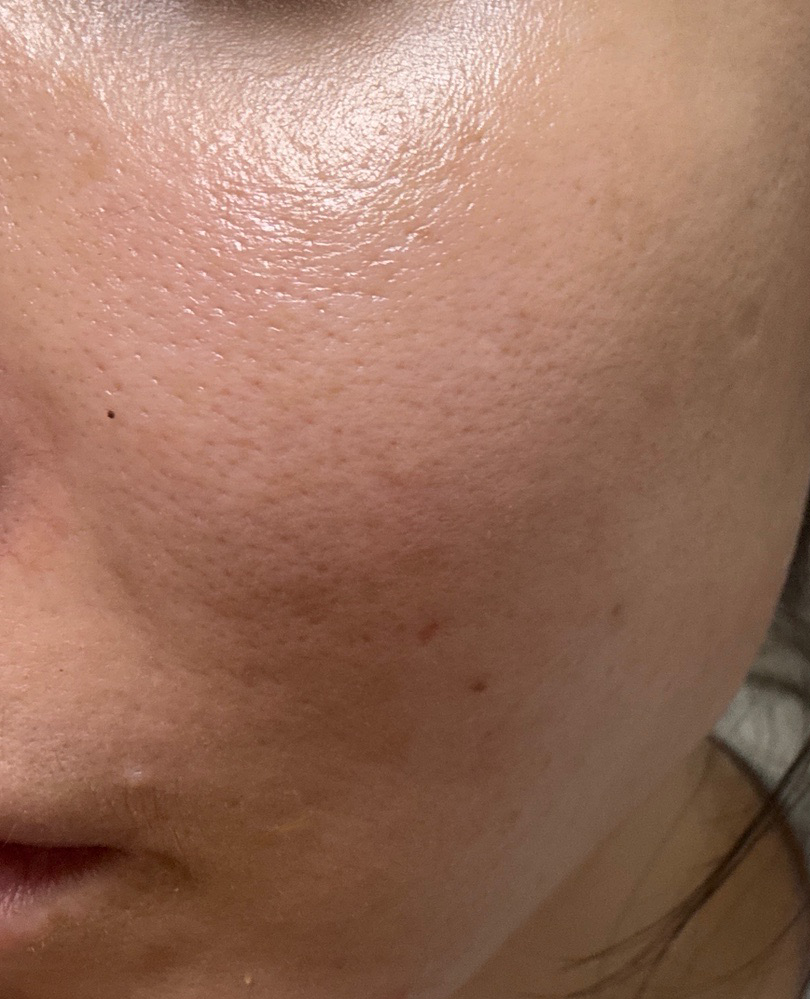 수술후기이미지