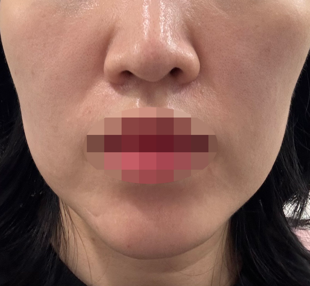 수술후기이미지