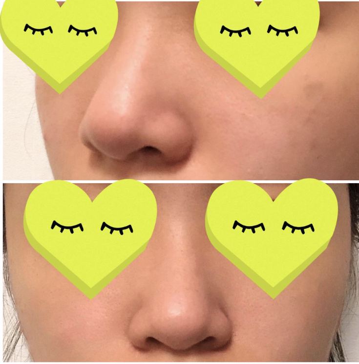 수술후기이미지