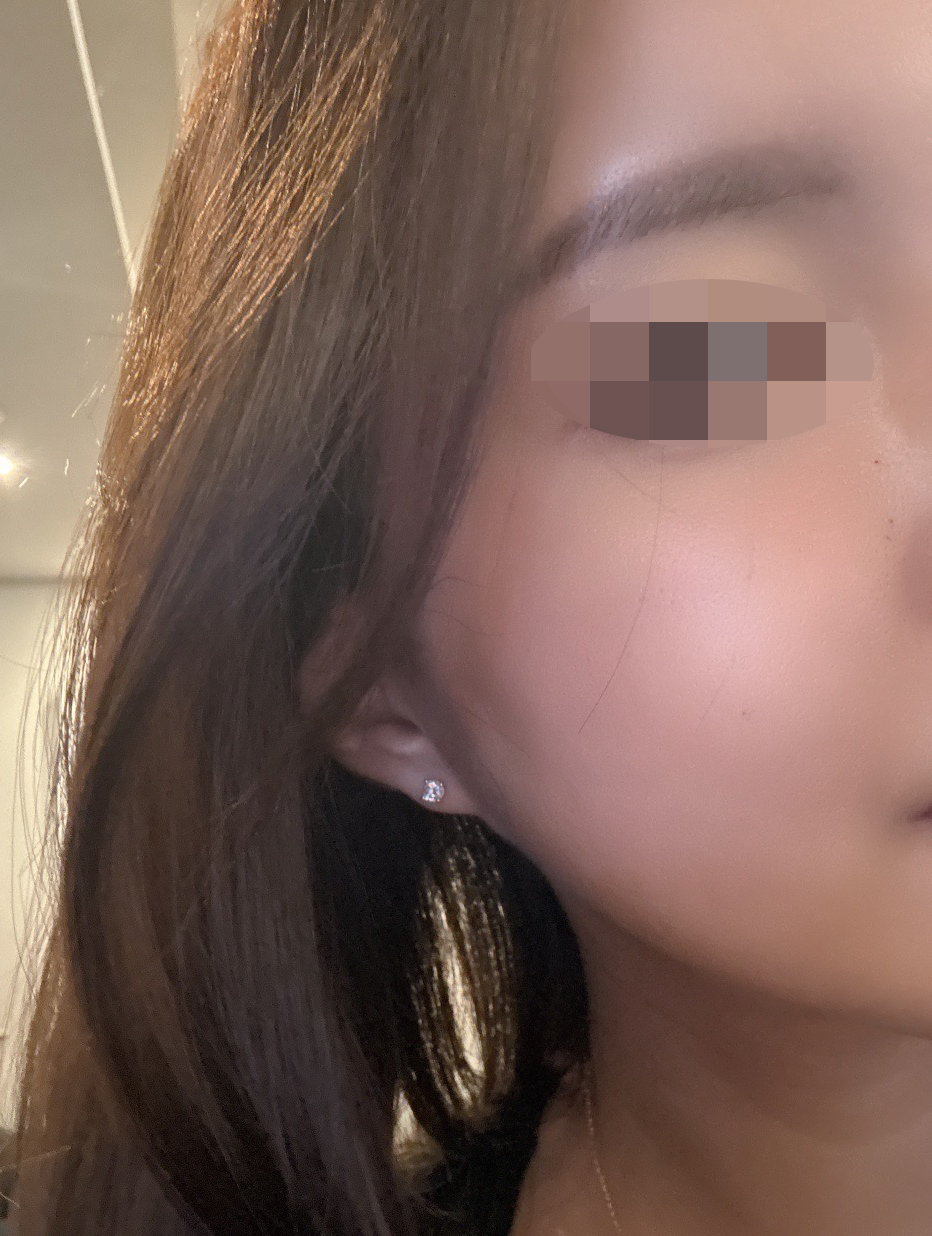 수술후기이미지