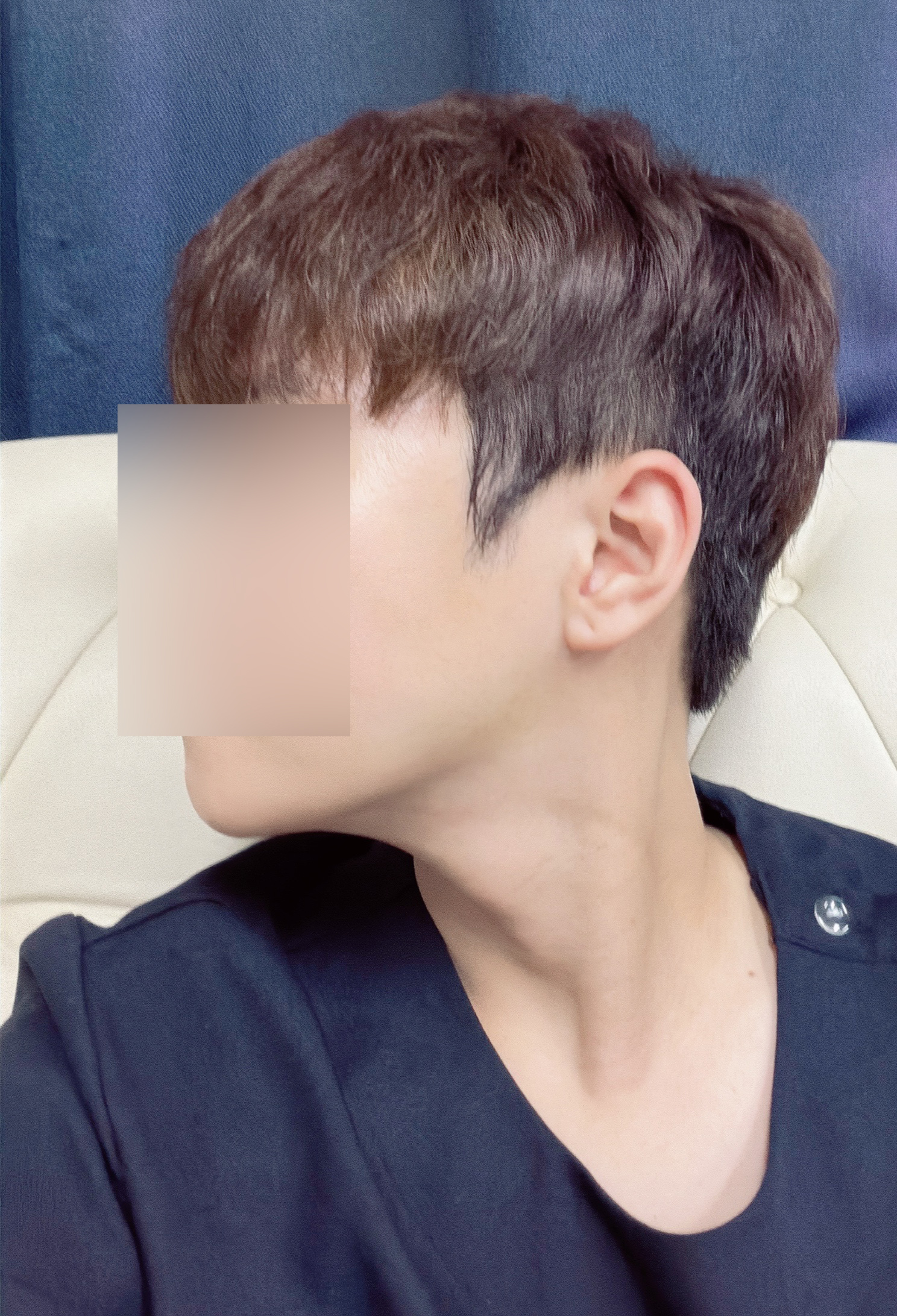 수술후기이미지