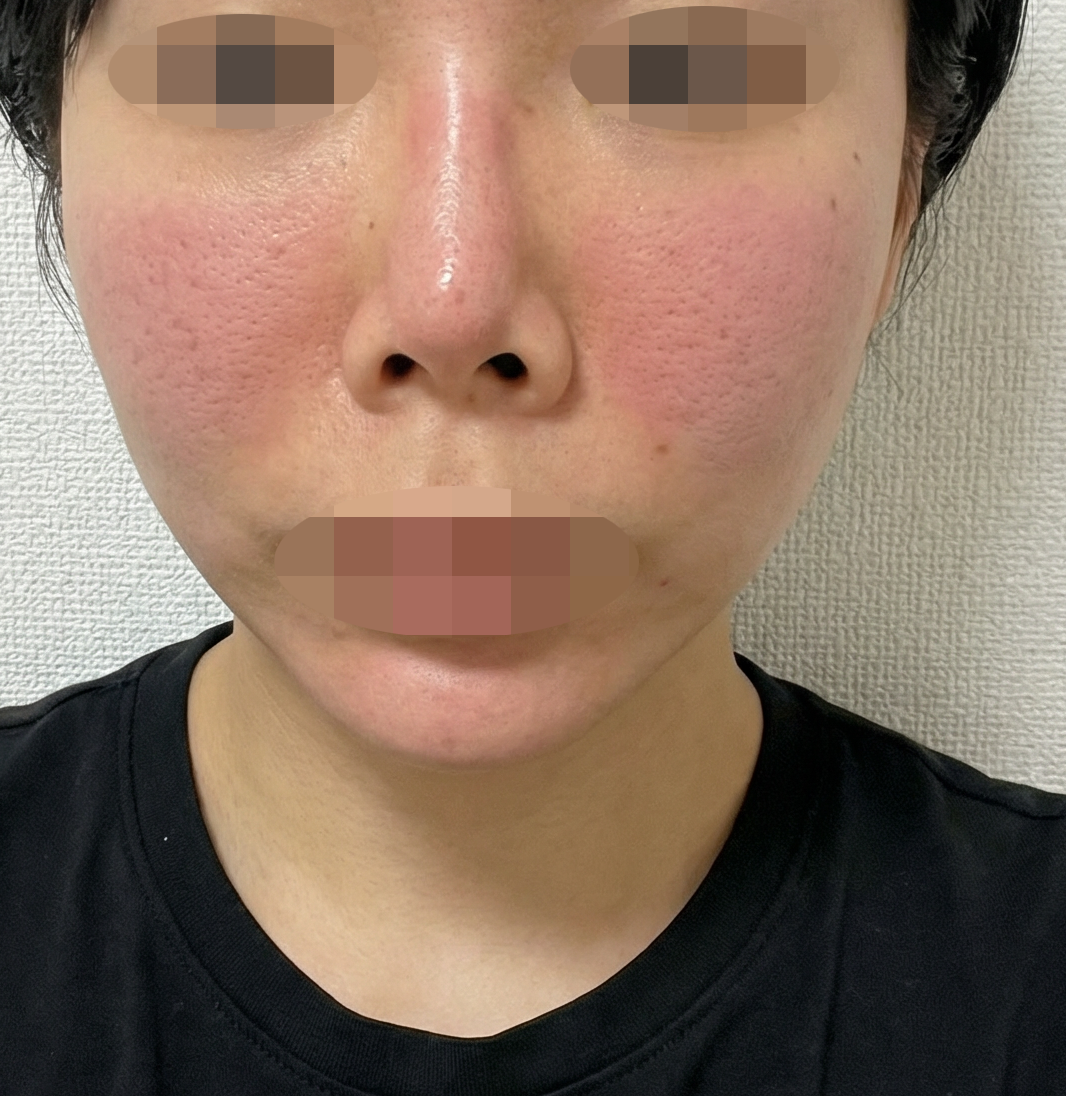 수술후기이미지