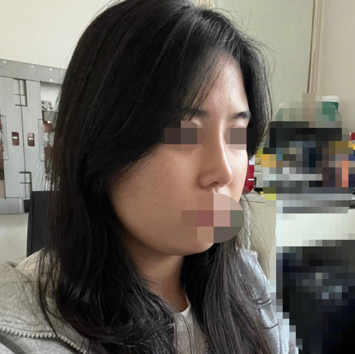 수술후기이미지