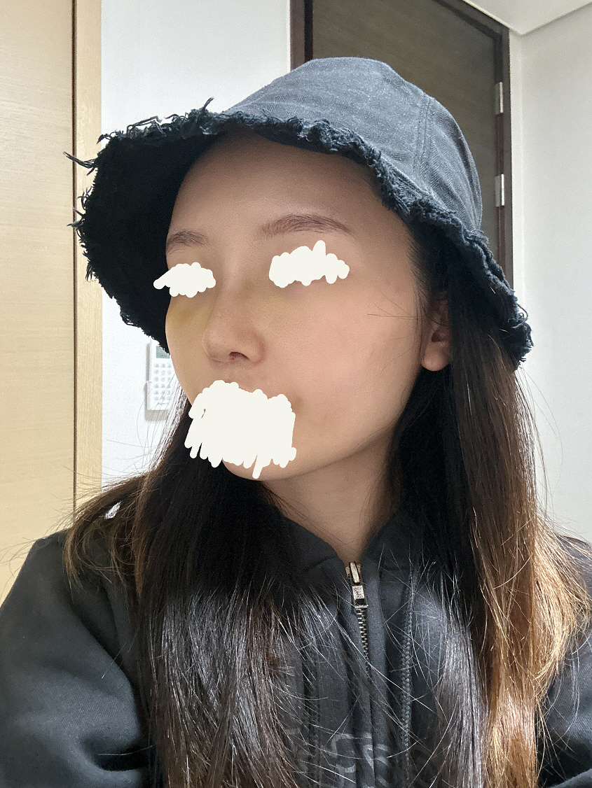 수술후기이미지