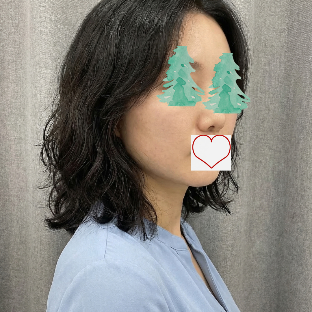 수술후기이미지