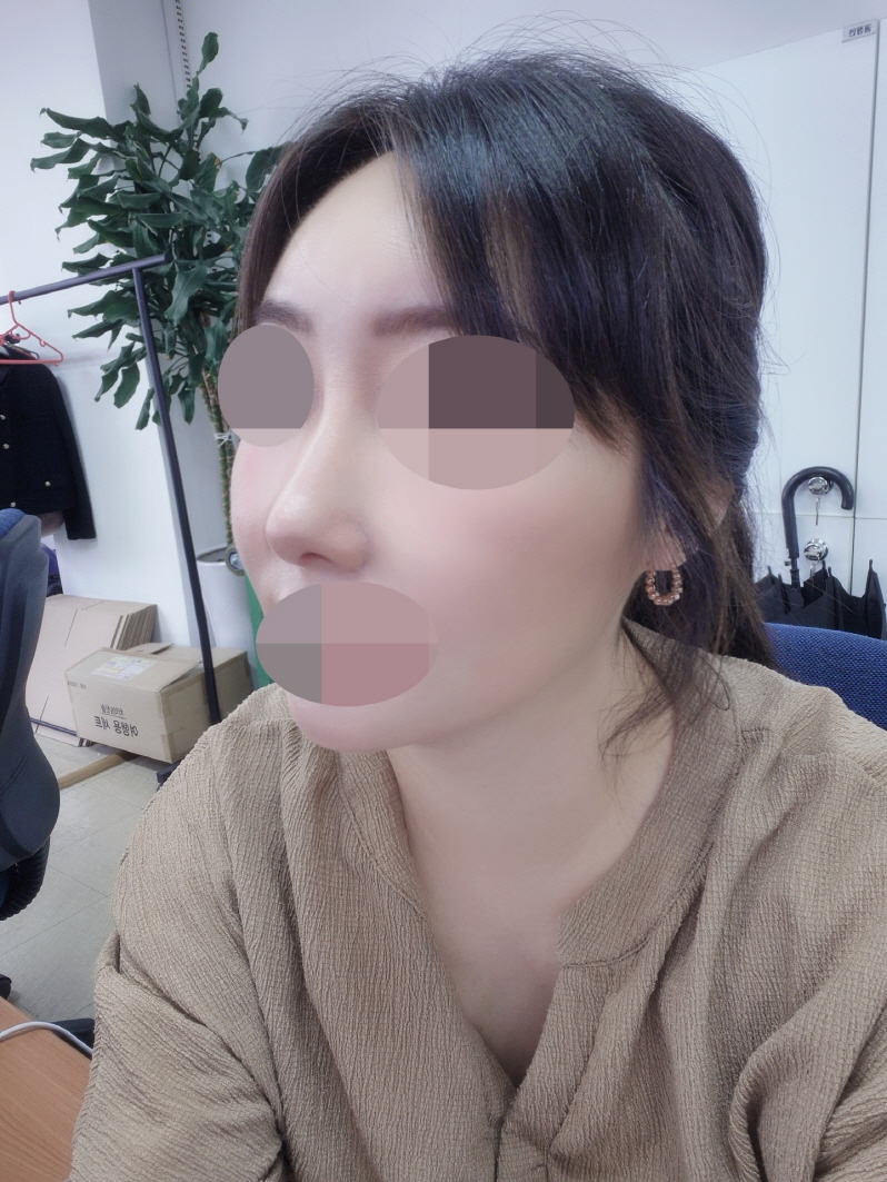 수술후기이미지