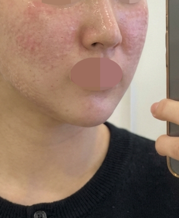 수술후기이미지