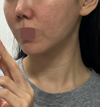 수술후기이미지