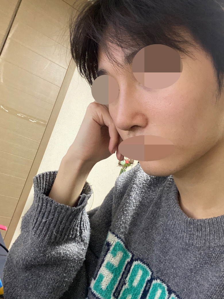 수술후기이미지