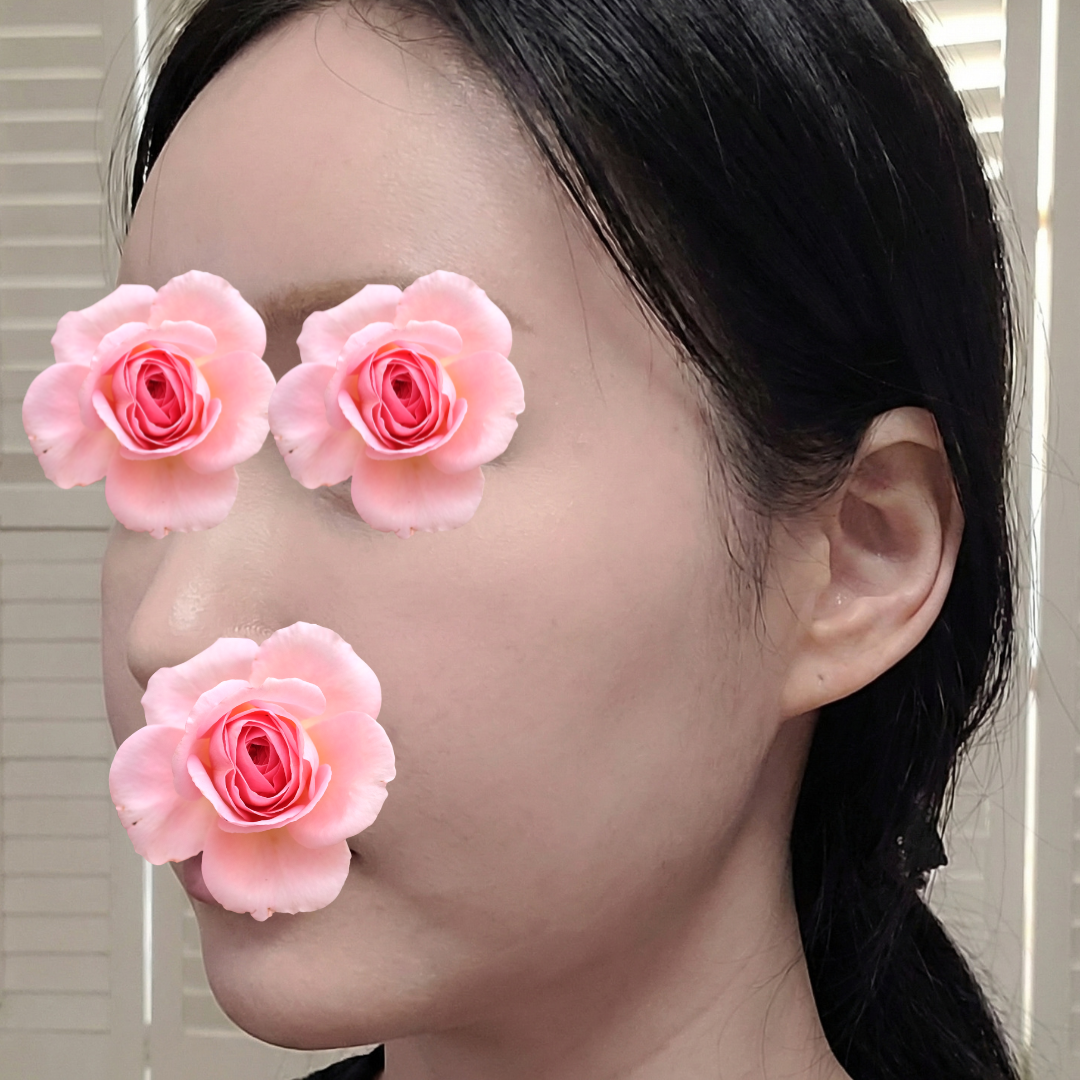 수술후기이미지