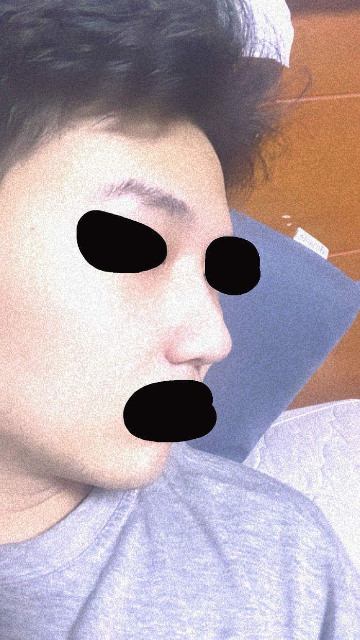 수술후기이미지