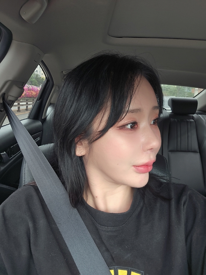 수술후기이미지