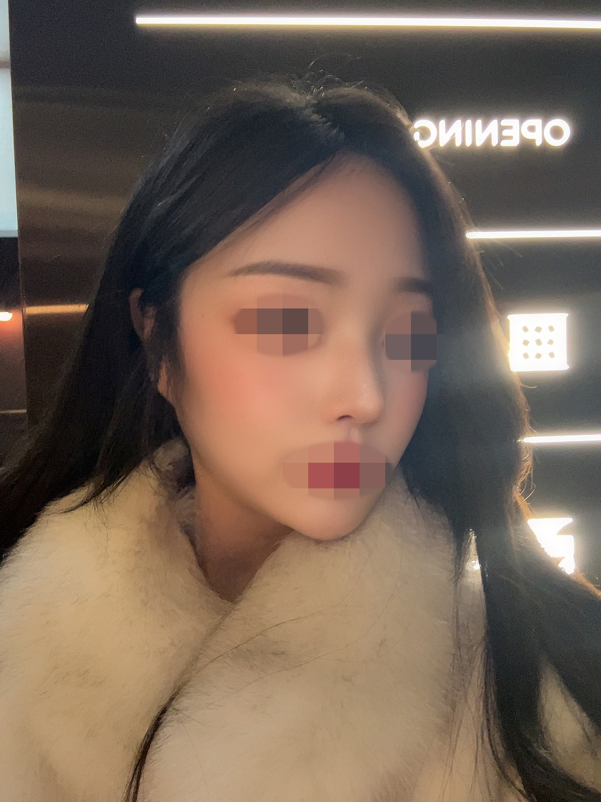 수술후기이미지