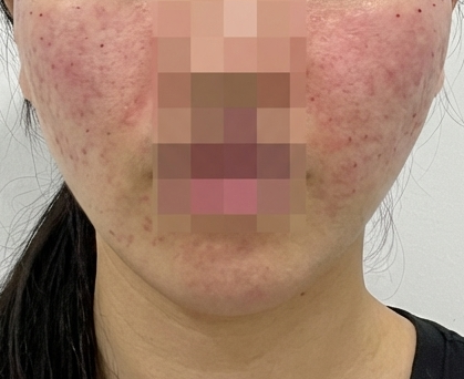 수술후기이미지