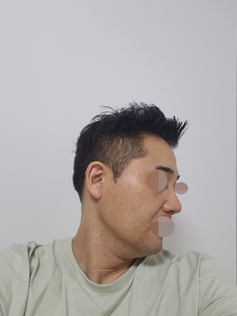 수술후기이미지