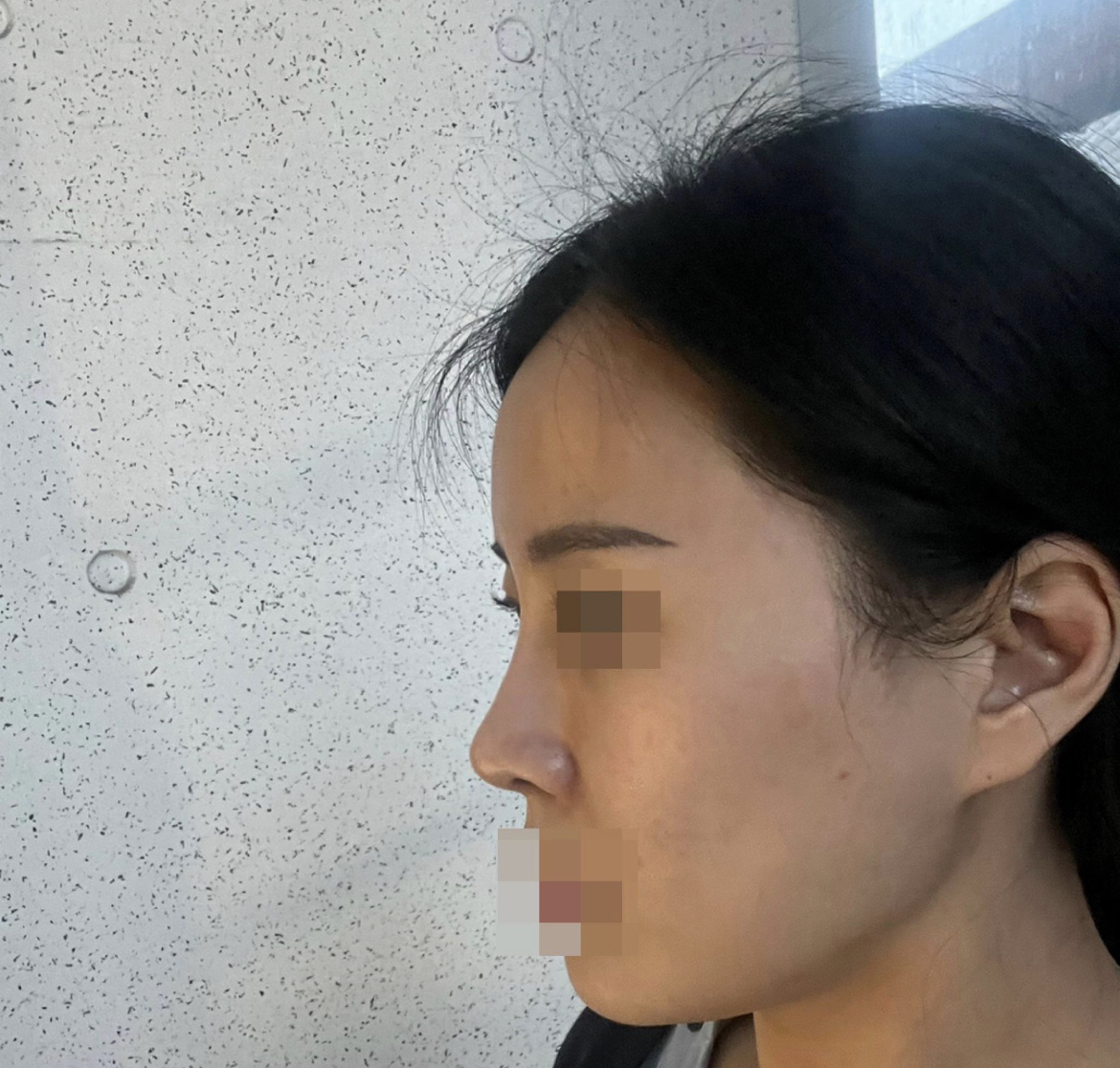 수술후기이미지