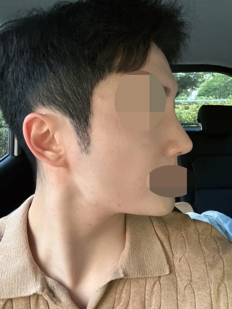 수술후기이미지