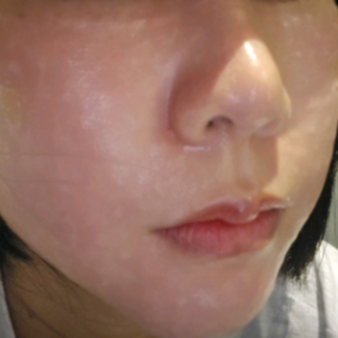 수술후기이미지