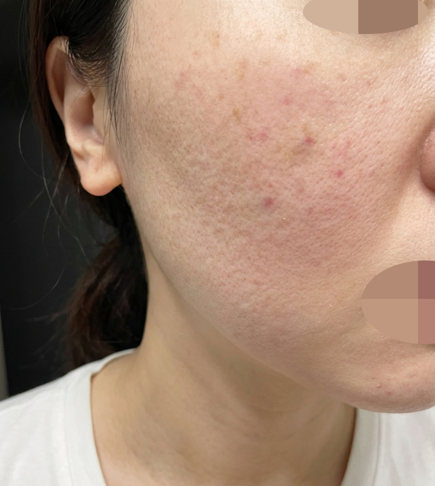 수술후기이미지