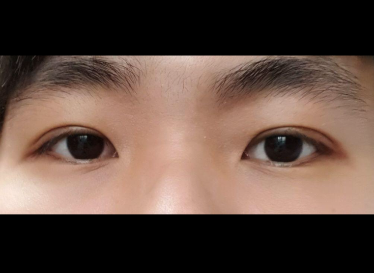 수술후기이미지