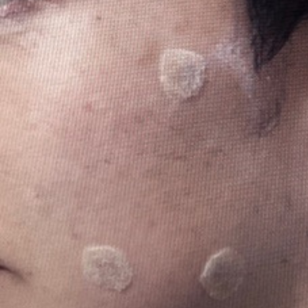 수술후기이미지