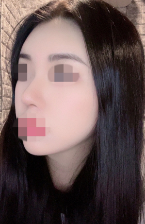 수술후기이미지