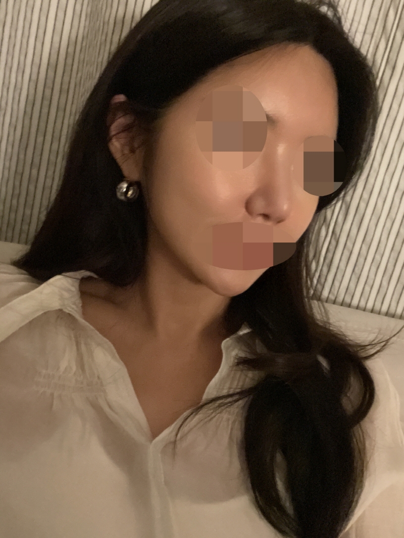 수술후기이미지