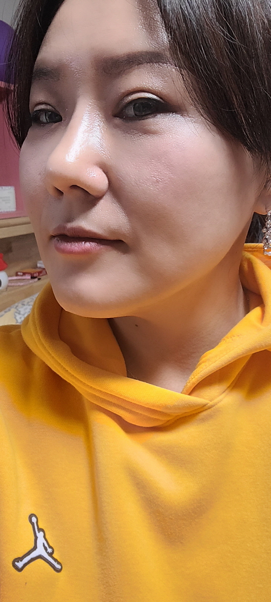 수술후기이미지