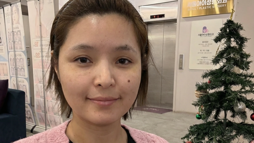 수술후기이미지