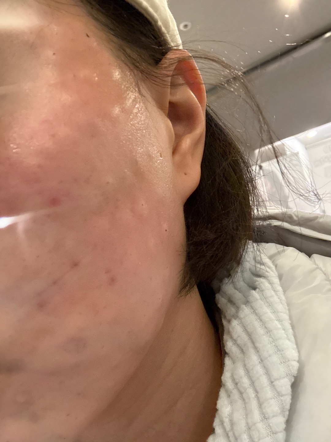 수술후기이미지