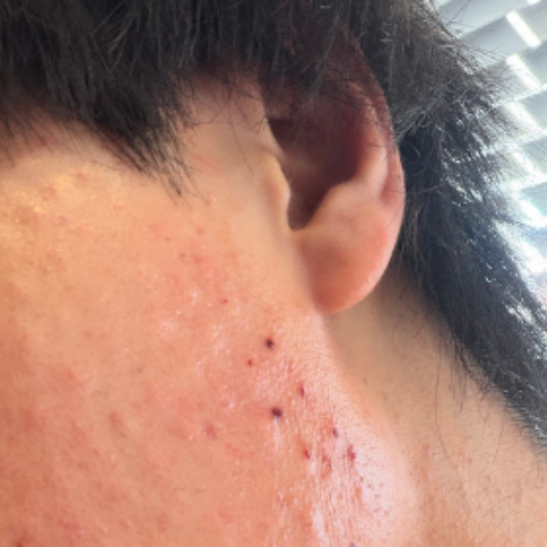 수술후기이미지