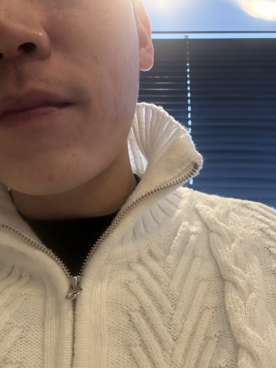 수술후기이미지