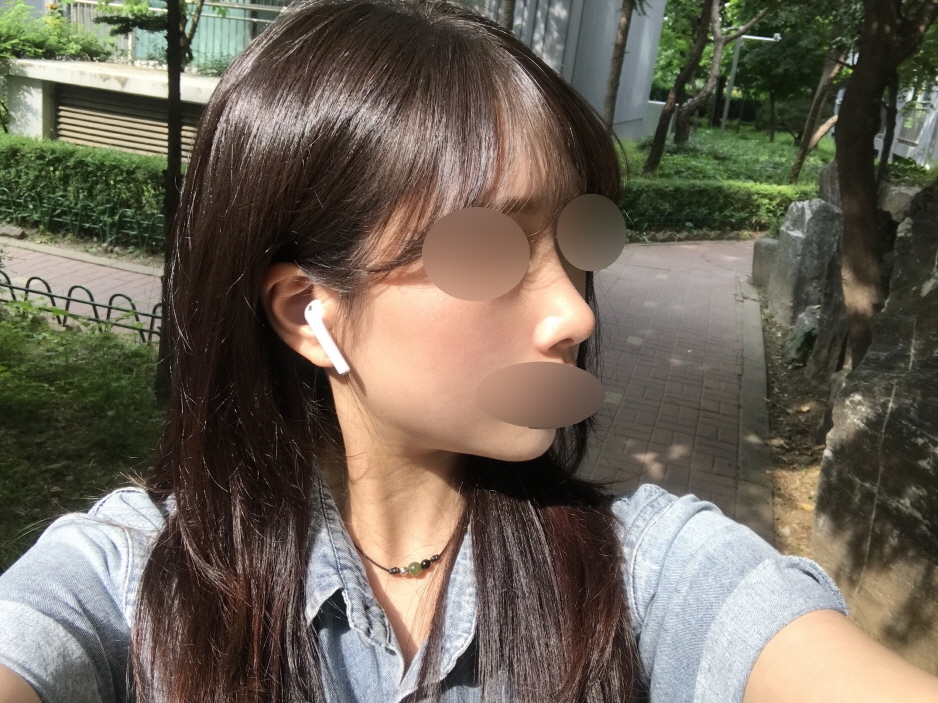 수술후기이미지