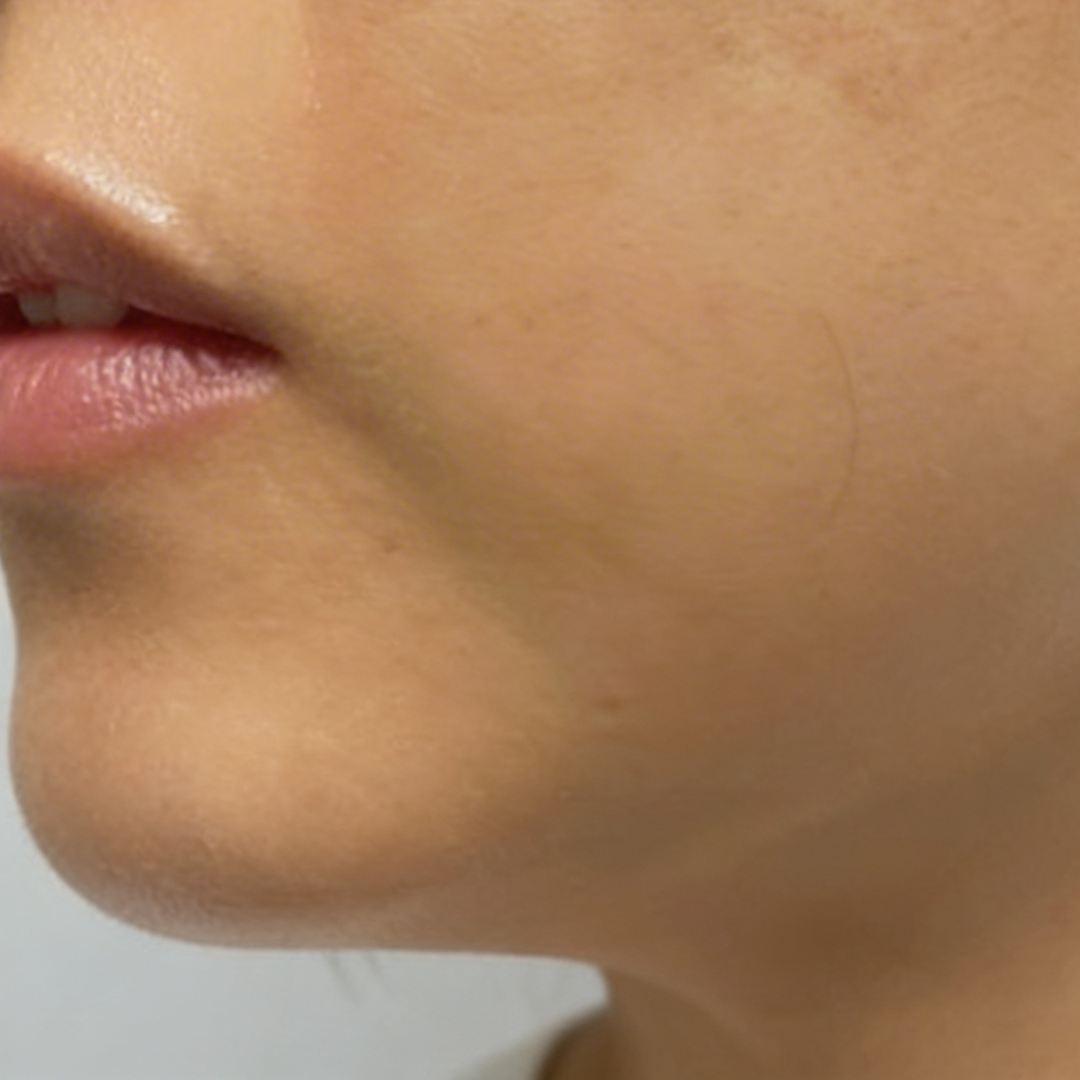 수술후기이미지