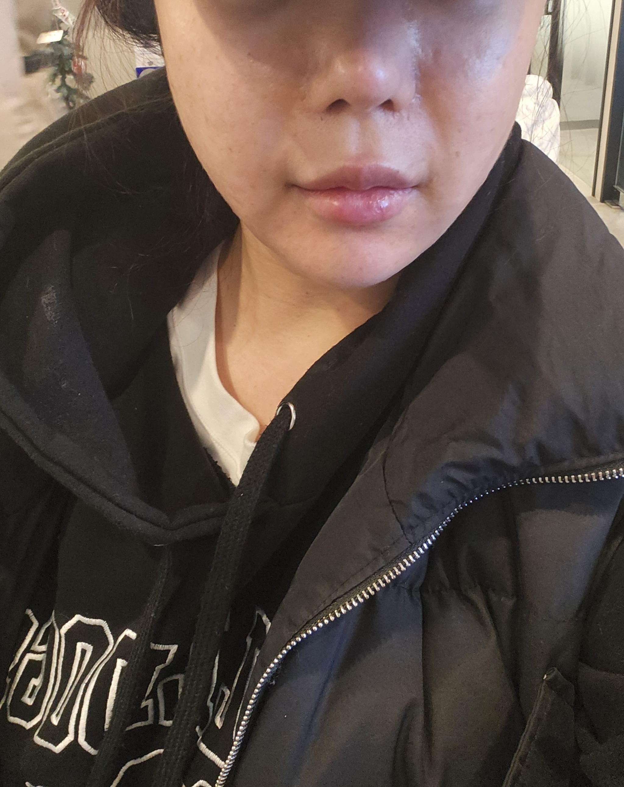 수술후기이미지