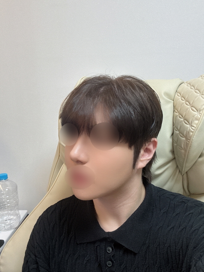 수술후기이미지