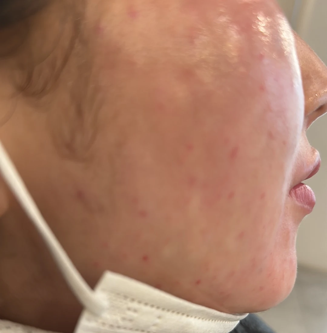 수술후기이미지