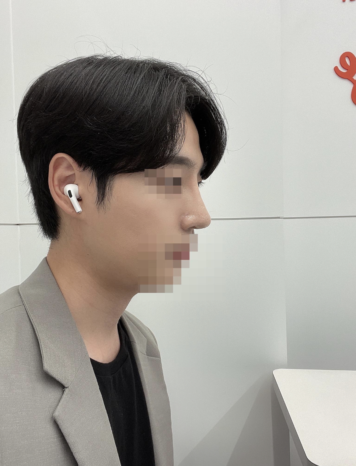 수술후기이미지