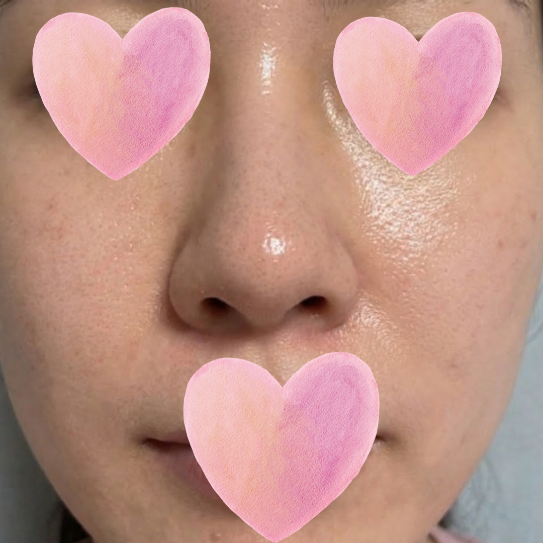 수술후기이미지