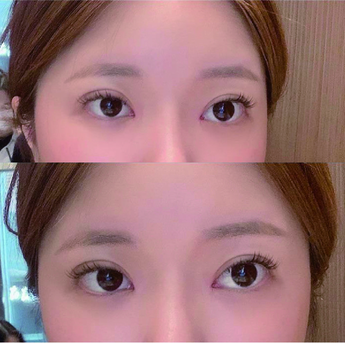 수술후기이미지