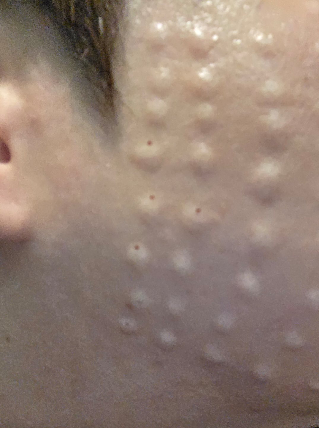 수술후기이미지