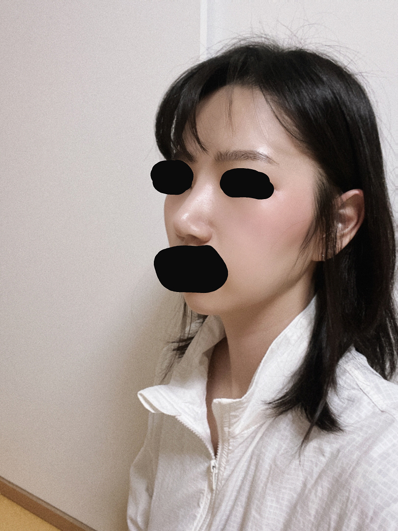 수술후기이미지