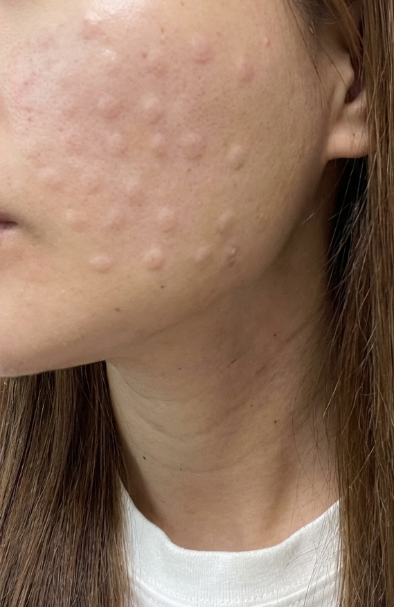 수술후기이미지