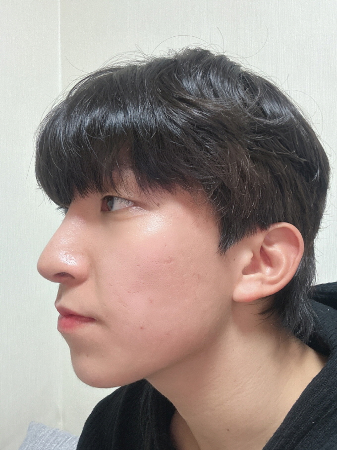 수술후기이미지