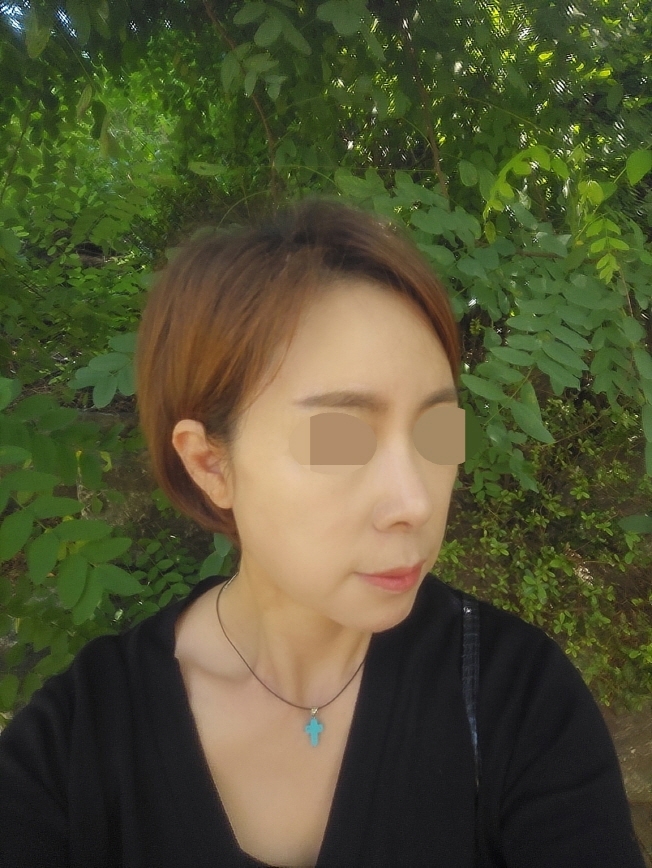 수술후기이미지