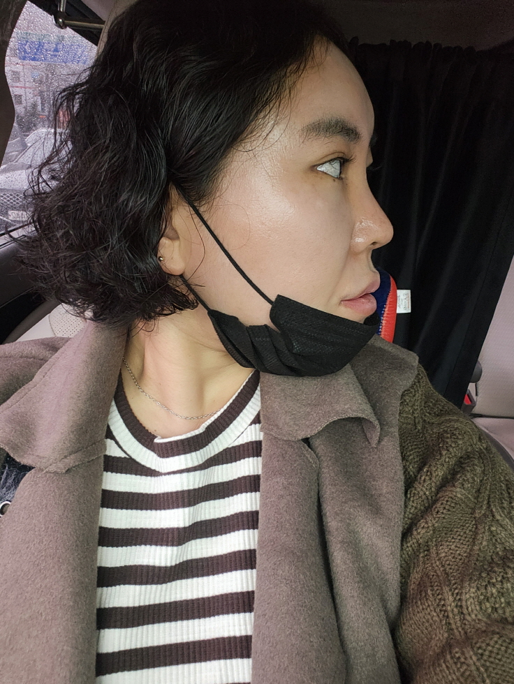 수술후기이미지