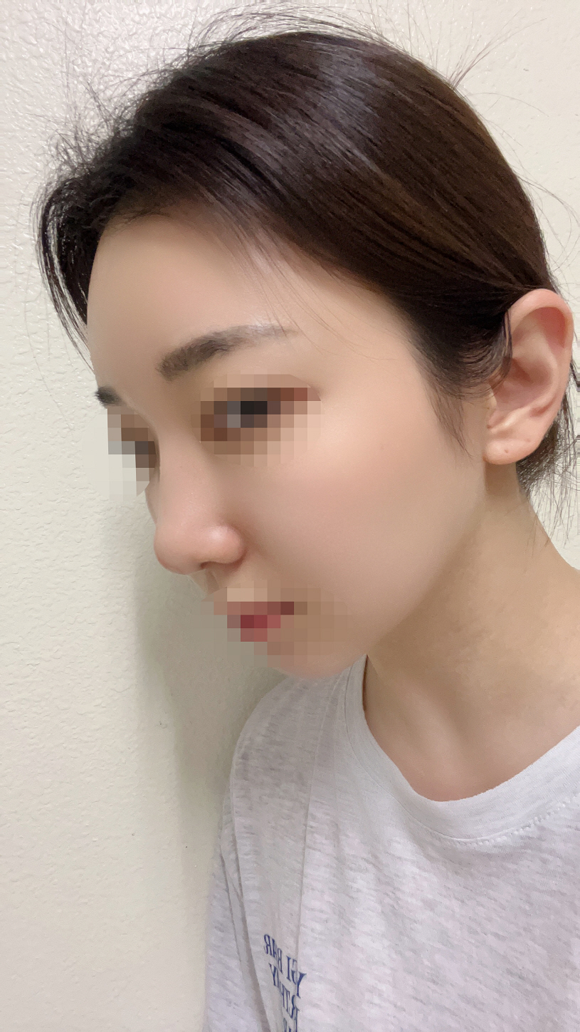 수술후기이미지