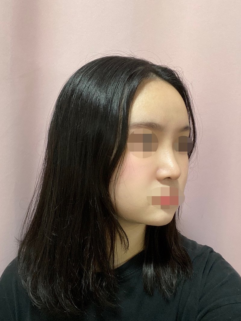 수술후기이미지