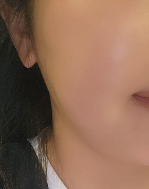 수술후기이미지